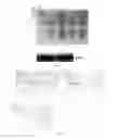 Fig. 02 - HUMAN FGFR2C EXTRACELLULAR PROTEIN AS WELL AS CODING GENE AND APPLICATION THEREOF