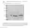 Fig. 41 - Glycoprotein hormone receptor mutations