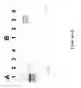 Fig. 07 - IMMUNOREACTIVE PROTEIN ORTHOLOGS OF EHRLICHIA CANIS AND E. CHAFFEENSIS