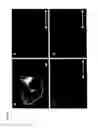 Fig. 04 - DERIVATION OF EMBRYONIC STEM CELLS