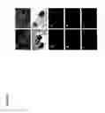 Fig. 07 - DERIVATION OF EMBRYONIC STEM CELLS