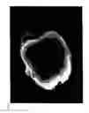 Fig. 08 - DERIVATION OF EMBRYONIC STEM CELLS