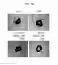 Fig. 17 - Method for secretion of extracellular vesicles from cells and tissues using shock wave