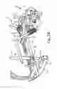 Fig. 03 - Spray control system for line striper sprayer