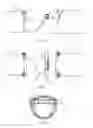 Fig. 05 - Passive exhaust valve assembly with overlapping slip joint and method of forming and installation