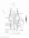 Fig. 02 - Gas turbine engine blade casing