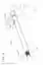 Fig. 06 - Speed change device for motorcycle