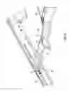 Fig. 04 - Universal attachment mechanism for sling
