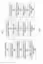 Fig. 06 - Amplified dual-gate bio field effect transistor
