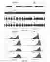 Fig. 06 - Normalizing signal energy for speech in fluctuating noise
