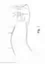 Fig. 02 - Hearing aid comprising a flexible connection member