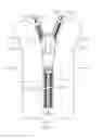 Fig. 01 - Slide Fastener and Method for Manufacturing Slide Fastener
