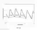 Fig. 09 - Method and apparatus for assessing respiratory distress