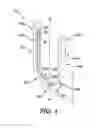 Fig. 02 - SURGICAL CLIP HAVING COMPLIANT PORTION
