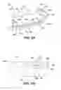 Fig. 03 - SURGICAL CLIP HAVING COMPLIANT PORTION