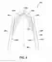 Fig. 09 - SURGICAL CLIP HAVING COMPLIANT PORTION