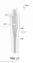 Fig. 14 - SURGICAL CLIP HAVING COMPLIANT PORTION