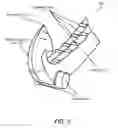 Fig. 04 - Surgical ligation clip