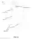 Fig. 07 - Surgical ligation clip