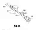Fig. 05 - Aspiration system for thrombectomy procedures