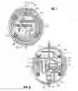 Fig. 10 - Aspiration system for thrombectomy procedures
