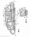 Fig. 11 - Aspiration system for thrombectomy procedures