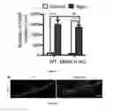 Fig. 07 - METHODS FOR TREATING NEUROMUSCULAR JUNCTION-RELATED DISEASES