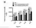 Fig. 33 - METHODS FOR TREATING NEUROMUSCULAR JUNCTION-RELATED DISEASES
