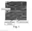 Fig. 02 - SKELETAL MUSCLE AUGMENTATION UTILIZING MUSCLE-DERIVED PROGENITOR COMPOSITIONS, AND TREATMENTS THEREOF