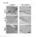 Fig. 08 - Method for treating arthritis using IK factor or nucleic acid encoding IK factor