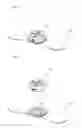 Fig. 02 - TRANSCUTANEOUS ELECTRICAL NERVE STIMULATION (TENS) APPARATUS
