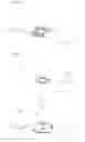 Fig. 09 - TRANSCUTANEOUS ELECTRICAL NERVE STIMULATION (TENS) APPARATUS