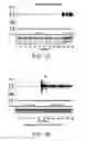 Fig. 08 - SYSTEMS AND METHODS FOR CONTROLLING A VENTRICULAR RATE DURING ATRIAL FIBRILLATION