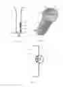 Fig. 03 - Adjusting system for a rear view element of a rear view device for a vehicle