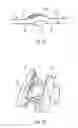 Fig. 27 - Streamlined flat windscreen wiper