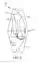 Fig. 07 - Power source element replacement during vehicle operation