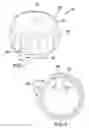 Fig. 02 - Screw-lid removal and attachment device