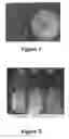 Fig. 02 - Epoxy composition