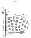 Fig. 07 - Reticulated materials for the formation of proppant-free channels