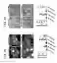 Fig. 04 - Use of the chromosome 19 microRNA cluster (C19MC) for treating microbial disease and promoting authophagy