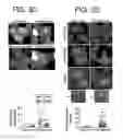 Fig. 05 - Use of the chromosome 19 microRNA cluster (C19MC) for treating microbial disease and promoting authophagy