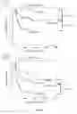 Fig. 11 - Methods for predicting response to DNA repair pathway inhibitors in diffuse large B-cell lymphoma