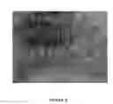 Fig. 04 - METHOD OF DIAGNOSING NEOPLASMS