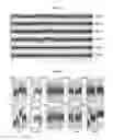 Fig. 09 - Algorithmic approach for determining the plasma genome abnormality PGA and the urine genome abnormality UGA scores based on cell free cfDNA copy number variations in plasma and urine