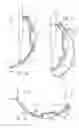 Fig. 07 - Pivotable handle for an architectural covering