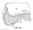Fig. 09 - Additive manufacturing controlled failure structure and method of making same