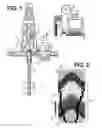 Fig. 02 - Formation density or acoustic impedance logging tool