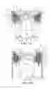 Fig. 02 - Piston with cooling gallery radiator and method of construction thereof
