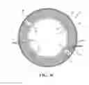 Fig. 06 - Piston with cooling gallery radiator and method of construction thereof