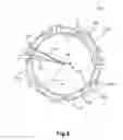 Fig. 04 - Connection ring for removable attachment of a fuel supply unit on a motor vehicle tank opening